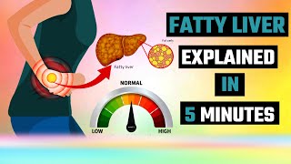 The Shocking Fatty Liver Truth EXPERTS Are Hiding [upl. by Yliak]