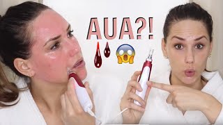 MICRONEEDLING FÜR ANFÄNGER  DERMAPEN TUTORIAL ANLEITUNG  KathisFinest [upl. by Arimaj]