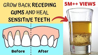 Xylitol Pulling Instead of “Oil Pulling” For Even Better Results [upl. by Nhguaval]