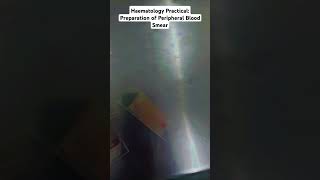 Haematology Practical Preparation of Peripheral Blood Smear in MBBS medico shorts [upl. by Kcorb891]