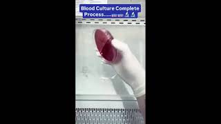 Blood culture  what is blood culture youtubeshorts science bmlt labstaff mlt microbiology [upl. by Hillel]