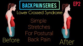 DrForamDhebarbackpain series Simple stretching exercise for lower cross syndromepostural backpain [upl. by Garett294]