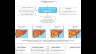 Treatment of Liver Cancer by Stage [upl. by Ellimac]