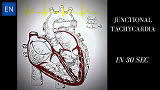 Junctional Tachycardia Animation and ECG Shorts [upl. by Martyn]