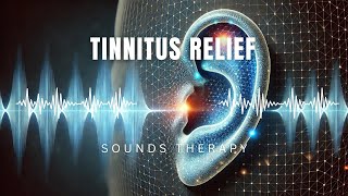 The Most Powerful Tinnitus Sound Therapy  Tinnitus Frequency  Tinnitus Cure [upl. by Annoyik]