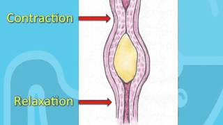 Swallowing Disorders and Achalasia [upl. by Rondon]