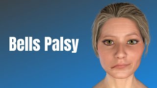 Bells palsy  Clinical Features and Management [upl. by Dickey]