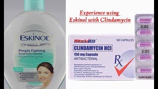 2019 Acne Story Part 1 EXPERIENCE Eskinol with dalacin cclindamycin [upl. by Zeuqirdor]