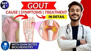 gout biochemistry  cause and symptom of gout  treatment of gout biochemistry [upl. by Randene259]