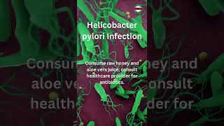 Helicobacter Pylori Infection Of the Stomach [upl. by Darra]