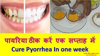 पायरिया ठीक करें एक सप्ताह में  Cure Pyorrhea In one week [upl. by Mag]