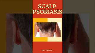 Top 3 Scalp Psoriasis Tips You Need to Know ScalpPsoriasis PsoriasisRelief [upl. by Eiramrebma]