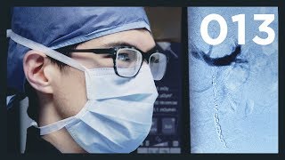 Treating Infertility with Metallic Coils  Varicocele Embolization Procedure  Vlog013 [upl. by Falo]