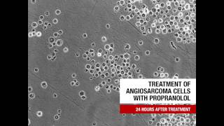 Treatment of Angiosarcoma Cells With Propranolol [upl. by Ylrebme]