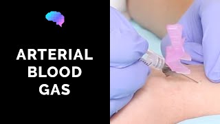 How to take an arterial blood gas ABG  OSCE guide  UKMLA  CPSA [upl. by Waylen]