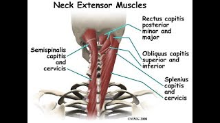 Craniocervical extensor exercise for whiplash injuries [upl. by Aunson]