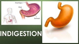 What does indigestion feel like What are the symptoms of functional dyspepsia [upl. by Ardnala]