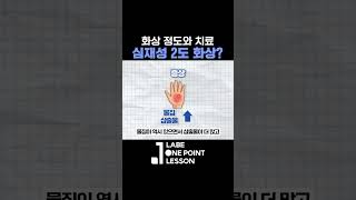 심재성 2도화상 화상의 깊이에 따른 종류와 초기처치의 중요성 성형외과 전문의 [upl. by Wj]