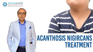 Acanthosis Nigircans Treatment  In Hindi  Dr Rohit Batra [upl. by Igal582]