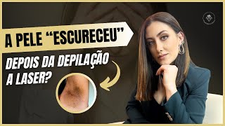 A pele do meu paciente escureceu pós depilação a laser e agora [upl. by Aleen]