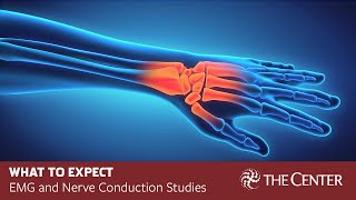 What to Expect During Nerve Conduction Studies and EMG Tests [upl. by Swane]