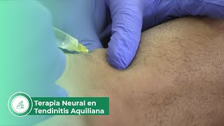 Terapia neural en tendinitis aquiliana [upl. by Adine122]