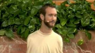 Never give up  Nick Vujicic  Life Without Limbs 3 HK [upl. by Cyndy617]