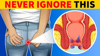 6 Signs of Colon Cancer You Should Know [upl. by Halil]