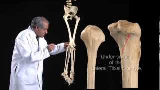 Lower Limb Fibula  Anatomy Tutorial [upl. by Leiahtan]