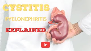 What is Cystitis  Cystitis Explained [upl. by Dallis461]