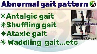 Abnormal gait pattern scissors gait  Antalgic gait  shuffling gait  Ataxic gait pattern [upl. by Ahsikyt]