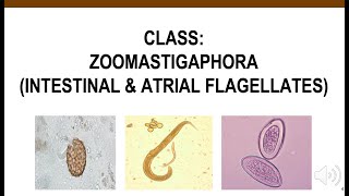 Intestinal amp Atrial Flagellates [upl. by Micro]