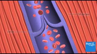 How deep vein thrombosis DVT forms  Bupa Health [upl. by Anit881]