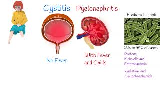 Cystitis Symptoms and treatment Painful urination Frequent urination [upl. by Roseanne]