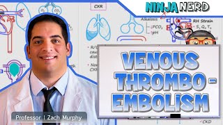 Venous Thromboembolism DVT PE  Clinical Medicine [upl. by Rebah]