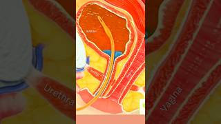 Urethral Catheter Insertion 🤯 shortvideo share status and [upl. by Stroud]