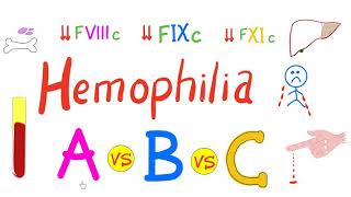 Hemophilia Types  hemophilia A Hemophilia B and Hemophilia C  Comparison  Genetics Hematology [upl. by Ogait557]