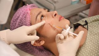 Dermal Filler Injection Techniques [upl. by Weinstock]