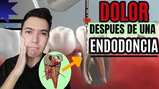 Por que me duele el diente después de una endodoncia me duele el diente después de una endodoncia👈😲 [upl. by Ammon]