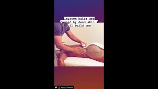 How to remove ingrown hair post waxing aftercare advice from Alexspot24 Men spa [upl. by Wise]