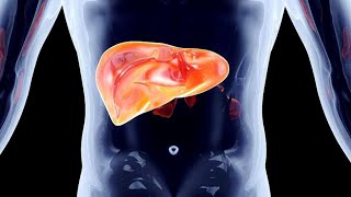 Mayo Clinic Minute When colon cancer spreads to the liver [upl. by Golliner]