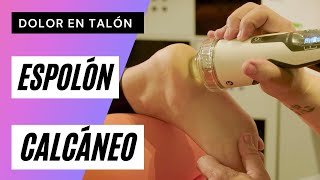 ESPOLÓN Calcáneo 🆘 DOLOR en el Talón 😖Causas y TRATAMIENTO [upl. by Quince669]