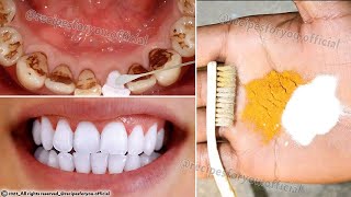 Secret that Dentists dont want you to know Remove Tartar and Teeth Whitening in just 2 minutes [upl. by Fazeli]