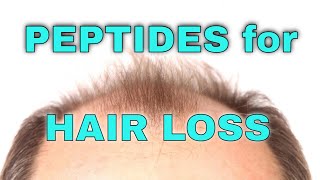 Peptides for Hair Loss [upl. by Anita]