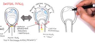 Obstetrics  Stage I of Labour [upl. by Assilaj]