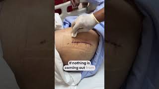 How to do surgical dressing at home like a DOCTOR  wounddressing totalhipreplacementsurgery [upl. by Eked629]