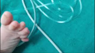 polydactyly baby newlyborn babydevelopment cute [upl. by Nattirb]