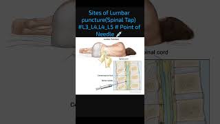 Lumbar puncture anatomyaimsloverbscnursingmedicalstudentpharmacypbbscnursingGnmtricksGDA [upl. by Tildie464]