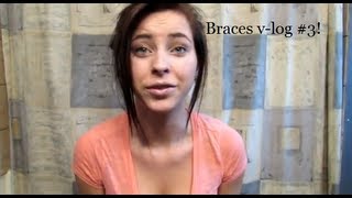 Braces vlog 3 [upl. by Esadnac]