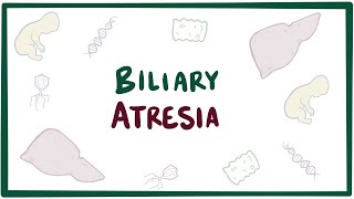 Biliary atresia  causes symptoms diagnosis treatment amp pathology [upl. by Kramlich836]